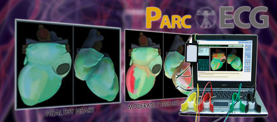 PARCECG - PARC ELECTROCARDIOGRAM